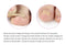 Ingrown Toenail Correction Sticker Patches - 10 Pieces