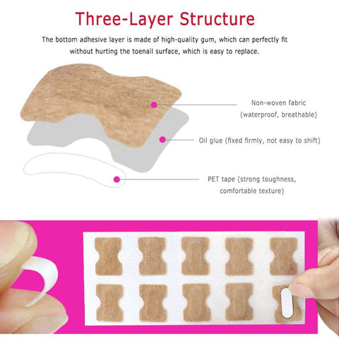 Ingrown Toenail Correction Sticker Patches - 10 Pieces